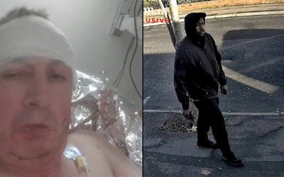 Kesaksian Pendukung Nottingham Forest yang Ditikam Tujuh Kali oleh Pelaku Penusukan Massal